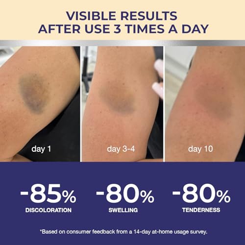Arnica Bruise Cream: Fast Healing Arnica Cream for Bruising Swelling Thin Skin - Enhanced Recovery Vitamin K Creams With Arnica Montana, VK, C&E ? Soothing Hydrating for senior, Adult, Kid, Pack of 2