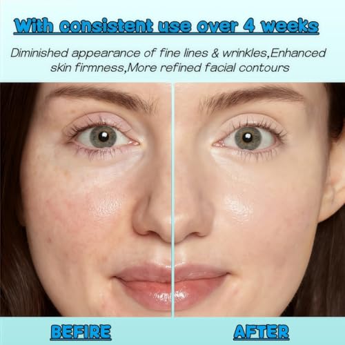 Neck Firming Cream with Retinol & Peptides | 6-in-1 Anti-Aging Moisturizer | Tighten & Lift Face & Neck | Fast-Absorbing, Smooths Visible Lines | Perfect Valentine's Day Gift for Her, 40ml
