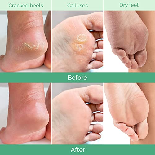 PLANTIFIQUE Foot Peeling Mask - 4 pack Dermatologically Tested to Repair Heels & Remove Dead Skin for Baby Soft Feet - Exfoliating Peel Mask for Cracked Feet