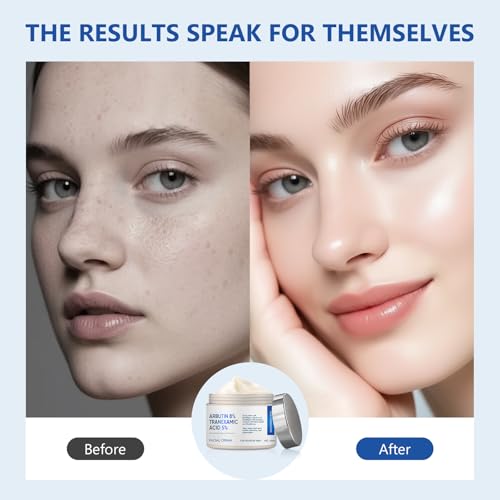 8% Arbutin & 5% Tranexamic Acid Cream - Advanced Brightening Face Moisturizer for Dark Spots & Uneven Skin Tone - Hydrating Facial Treatment for Radiant Complexion