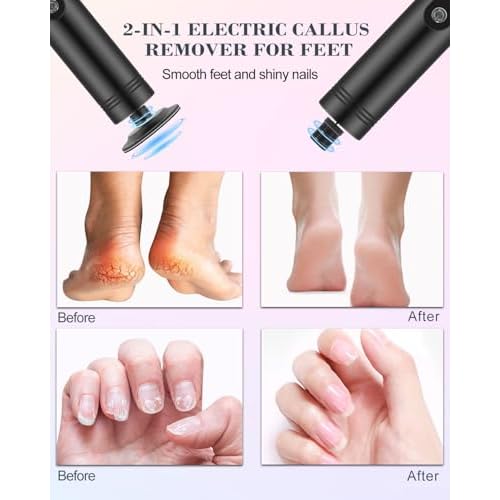 2 in 1 Electric Foot Callus Remover, 9 Speed Adjustable Foot Sander with LED Display, Electric Foot Grinder with 2000 mAh Rechargeable Battery, for Callus Removal, Replaceable Sandpaper Discs (Black)