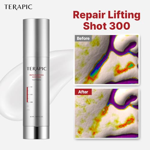 Repair Lifting Shot 300 ? Korean Skin Booster Serum with Micro EC-Spicule ? Clinically Tested for Pore Care, Wrinkle Reduction & Skin Elasticity (50ml)