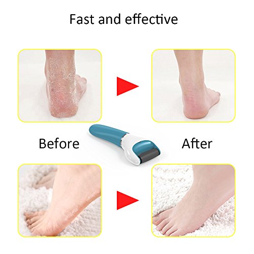 Electric Foot File Callus Remover Professional, 2-Speed Rechargeable Pedicure Tool for Remove Calluses, Dry, Hard, Dead, Cracked Skin, Includes 2 Coarses (Blue)