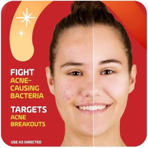 Asepxia 2% Salicylic Acid Acne Spot Treatment Cream | Drying Formula Targets Acne, Clears & Prevents Blemishes, Reduces Redness, Penetrates Pores, Pimple Cream, 1 Oz, 3-Pack