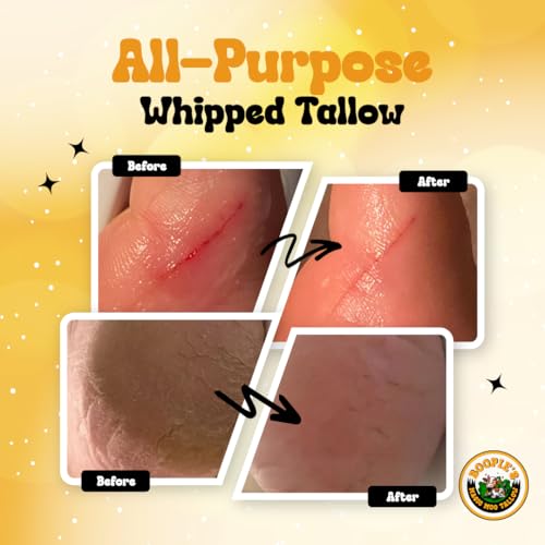 Magic Moo All Purpose Whipped Beef Tallow Skincare for Acne, Eczema, Dry Skin, Moisturizer, Stretch Marks & Hydration. Suet Tallow for Face with Organic Emu Oil. Contains All Organic Ingredients, 2oz