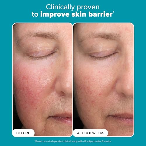 Paula¡¯s Choice 6% Mandelic Acid + 2% Lactic Acid Exfoliant, Gentle Daily AHA Exfoliation for Discoloration, Bumpy Texture & Radiance, for Sensitive Skin, Fragrance-Free