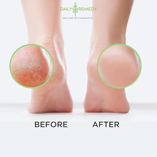 Tea Tree Oil Foot Soak with Epsom Salt - Made in USA - for Toenails, Athlete's Foot, itchy Feet, Stubborn Smelly Foot Odor, Pedicure, Foot Calluses & Soothes Sore Tired Achy Feet - 64 oz