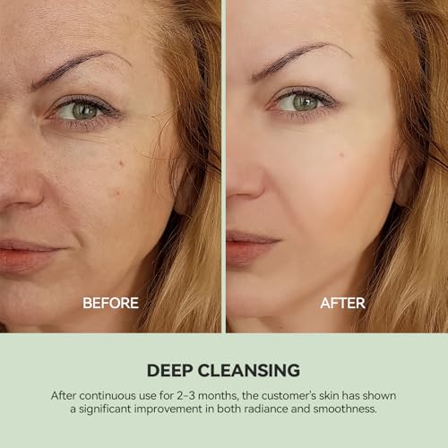 WNP Duo Cleansing Clay Mask with Niacinamide & Hyaluronic Acid ? Deep Pore Cleanser for T-Zone & U-Zone, Blackhead Remover, Hydrating & Oil-Control Face Mask, 3.53oz