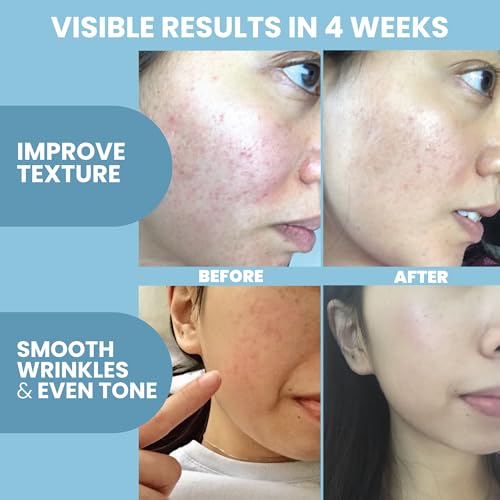 Eva Naturals Multi Peptide Face Serum ? Anti Aging Collagen Peptides for Plump & Firm Skin Elasticity, Wrinkle & Fine Line Renewal, Fragrance Free Firming Facial Skincare - 2 oz