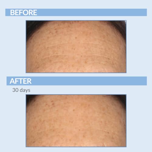 Serious Skincare Retinol Cream For Face - Vitamin A Cream XR Premium Moisturizer - Anti-Aging - Day & Night - Reduce Fine Lines & Wrinkles - For Radiant Skin 2 Fl. Oz.