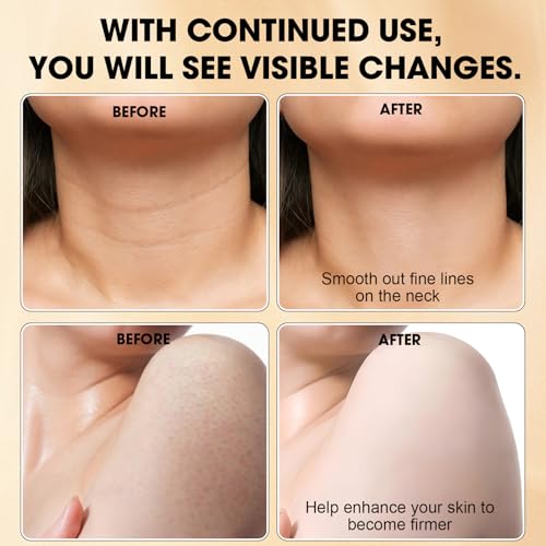 Champagne Body Cream, Champagne Lift Body Creme with Firming Complex & Pink Pepperslim, Deep Hydration & Smoothing Body Cream, Firms & Lifts Arms & Legs, Hydrates Dry Skin, Vanilla Scent