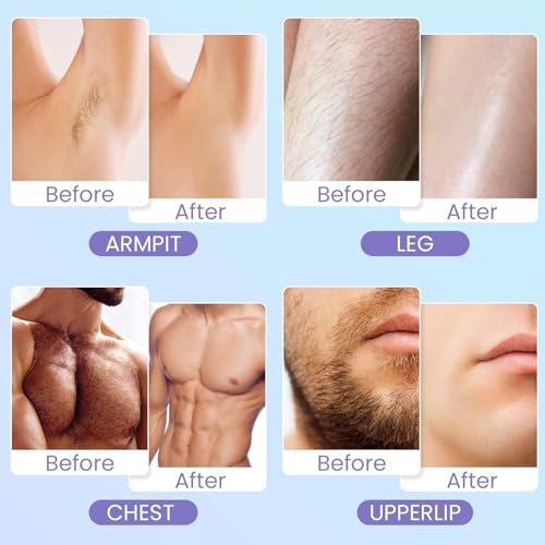 ZJchao Electric Depilatory Roll On Brazilian Wax Heater, Portable Wax Warmer with LCD Temperature Display for Home and Travel Use (US Plug 110V)