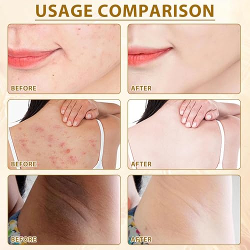 Bee Venom Skin Treatment Cream, Bee Venom Cream for Women and Men, Natural Bee Venom for All Skin Types, 2.12 OZ
