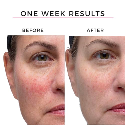 Hey Honey Good Morning Honey Silk Facial Serum | Anti-Aging Vitamin C & Hyaluronic Acid Serum for Radiant Skin Boosts Glow, Smooths Fine Lines, Strengthens Skin Barrier | 1 oz