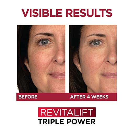 L'Oreal Paris Revitalift 1.5% Pure Hyaluronic Acid Face Serum + Triple Power Anti-Aging Face Moisturizer, 1 kit