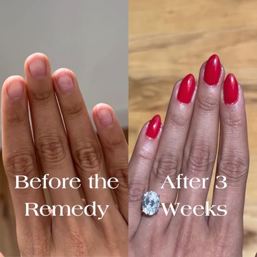 Botanist Nail Strengthening Manicure Kit | Everything Needed for Longer, Stronger Nails | Grow and Strengthen Damaged Nails | Non-Toxic, 84% Plant Based, 21-Free & Vegan (Poppy Red)