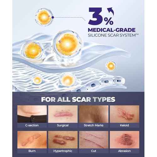 Silicone Scar Cream with 6.7% Active Ingredients, Scar Gel Visible in 2 Weeks, Moisturizing Scar Removal Clinically Show for Surgical, C-Section, Keloid, Acne & Burn Scars, Stretch Mark Cream(55ML)