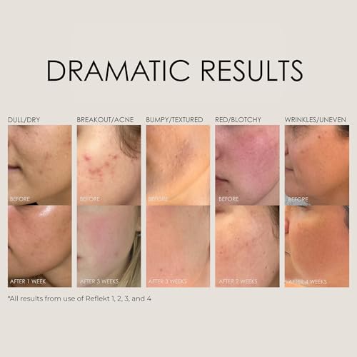 REFLEKT 3 ? Power Peptide Sculping Face Cream ? Polyglutamic Acid (PGA), Squalane & Hyaluronic Acid for Renewed, Smoother & Firm Skin. Clean, Vegan, Cruelty-Free, Fragrance & Paraben-Free Formula