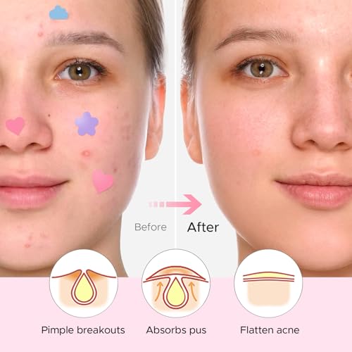 LitBear Acne Pimple Patch, 6 Sizes 252 Dots Cute Pimple Patches with Salicylic Acid, Tea Tree Oil & Calendula Oil, Hydrocolloid Acne Patches for Face, Colorful Zit Patch Blemish Sticker Acne Dots