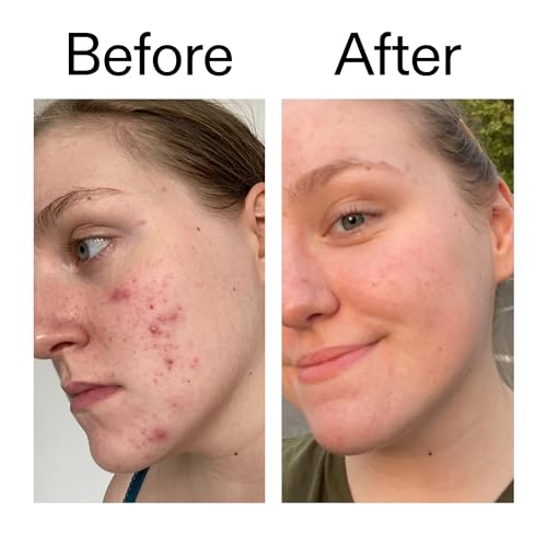 Body Prescriptions Exfoliating Body Scrub ? Body Cleanser for Nourished, Ultra-Smooth Skin, Honey Citrus, Coconut Almond, and Sweet Mint