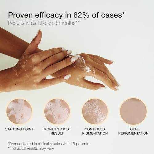 LULLAGE Repigment12 White Patches Corrector Cream for Dry Skin and Sensitive Skin, Paraben-Free Repigmentation Face and Body Cream for Women and Men, 2.5 Fl Oz