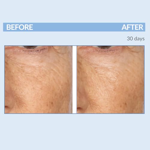 Serious Skincare Retinol Cream For Face - Vitamin A Cream XR Premium Moisturizer - Anti-Aging - Day & Night - Reduce Fine Lines & Wrinkles - For Radiant Skin 2 Fl. Oz.