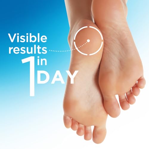 Flexitol Heel Balm,Cracked Heel Cream & Foot Balm,Intensive Hydration for Dry,Rough Feet & Heels,Urea-Based Moisturizing Cream,4 oz Tube,(Pack of 4)