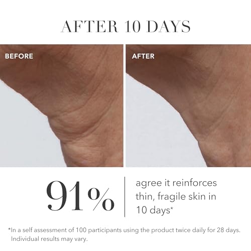 Algenist GENIUS Ultimate Anti-Aging Cream, Travel Size - Vegan Firming & Smoothing Moisturizer with Alguronic Acid & Microalgae Oil - Non-Comedogenic & Hypoallergenic Skincare (0.5 oz)