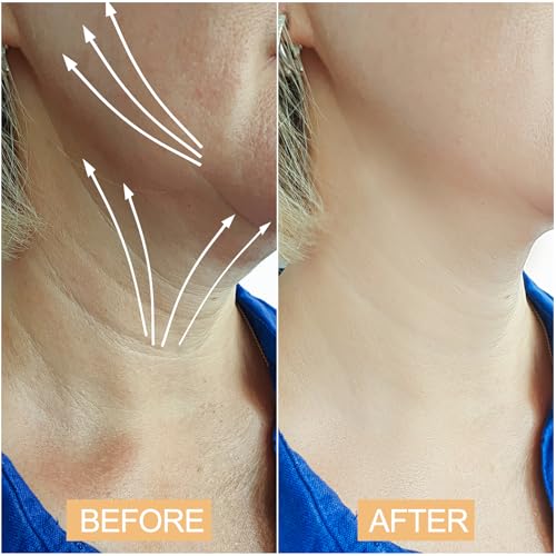 Neck Lift Tape ? Invisible Double Chin Tape for Women, Instant and Natural-Looking Facelift, Sweat-Resistant and Skin-Friendly Neck Tightening and Lifting