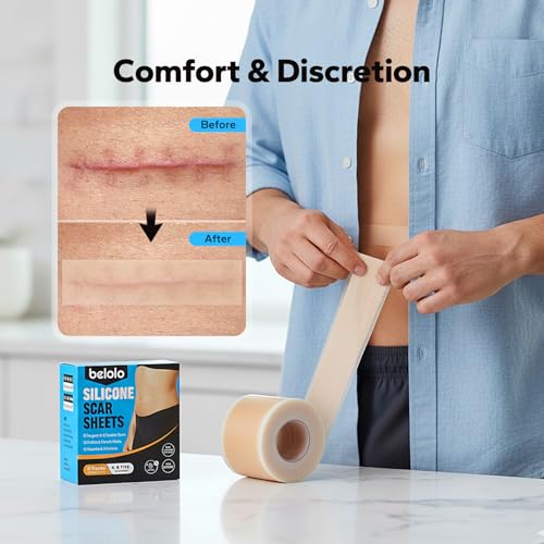 Silicone Scar Sheets (1.6" x 60" Roll - 1.5M), Silicone Scar Tape, Silicone Scar Sheets for Surgical Scars, Keloids & C-Section Scars, Reusable & Washable Scar Patches for Face & Body