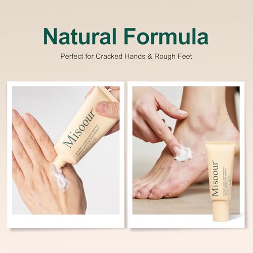 25% Urea Hand Cream for Feet with 2% Salicylic Acid & 5% AHA+Aloe Vera, Urea Foot Cream for Dry Cracked Hands, Heels and Feet, Moisturizer and Repair for Rough Skin
