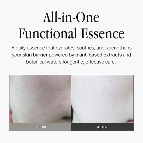 Essence 4.06 fl oz ? Hydrating Brightening Essence with 20,000ppm Niacinamide, Panthenol, Patented Derma-Clear Complex for Sensitive Skin & Skin Barrier Support