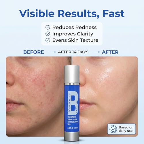 Niacinamide Spray - Topical Mist with Hyaluronic Acid, Glycerin, Vitamin B3, and Aloe for Skin Clarity, Texture & Hydration - Gentle Niacinamide Serum Alternative - 3.6 fl oz