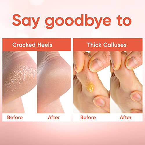 C?LOR Foot Peeling Mask for Dry Cracked Feet | Foot Mask to Exfoliate Rough, Cracked, Dry Feet, Calluses for Soft Baby Feet Results | Made with Aloe Vera Extract for Women & Men (5 Pairs) | Peach