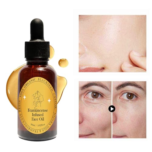 Frankincense Resin Oil for Face, Frankincense Oil for Skin, Frankincense Resin Infused Organic Black Seed, Castor & Jojoba Oil for Face, Facial Moisturizing Anti-Aging Serum (1PC, 1)