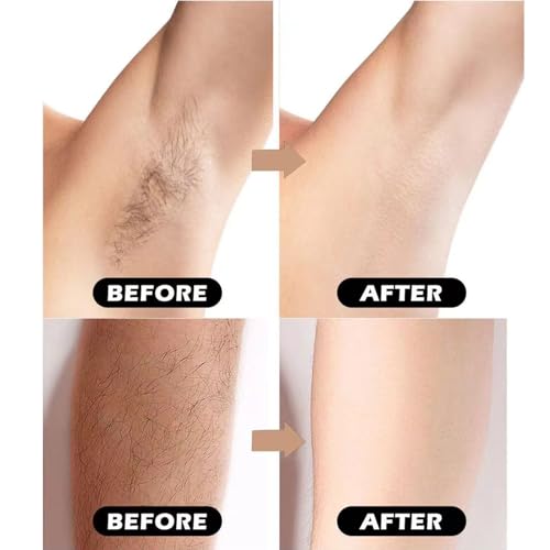 Razors for Women Sensitive Skin£¬6 blade Lady Shaving Razor for Women, Women¡¯s razors for Shaving Including 1 Travel Razors for Women with 19 Blade Refills