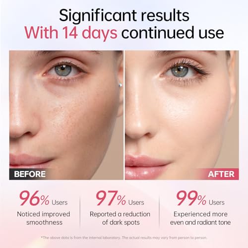 BOLI PDRN Serum, Salmon peptide Niacinamide Serum Hydrating, Moisturizing, Uneven Skin Tone Essence (1.01 fl oz)