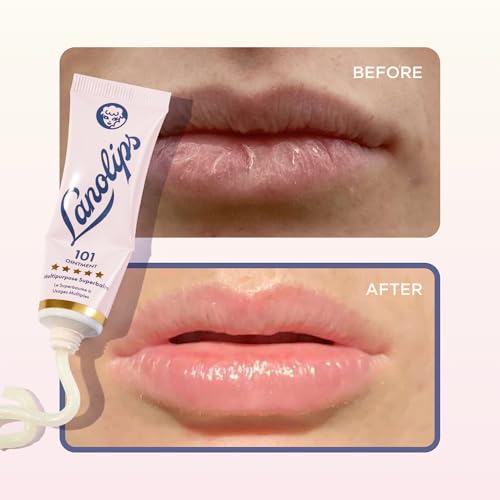 Lanolips Hydration All Over Bundle - 3-Piece Lanolin Balm Set for Dry, Cracked Lips and Skin - Includes 101 Ointment, Golden Dry Skin Salve & Everywhere Multi Cream for Daily Hydration - 3-Piece Set