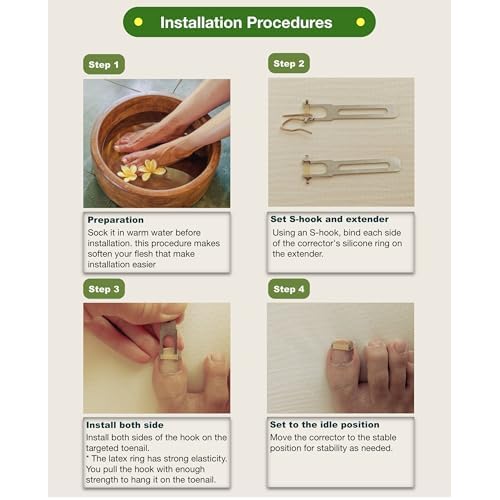 Ingrown Toenail Treatment & Corrector with Latex Elasticity - Curved Toenail Straightener | Effective Daily Solution for Ingrown Toenail Pain & Growth Correction [S/0.67inches/16-18mm]