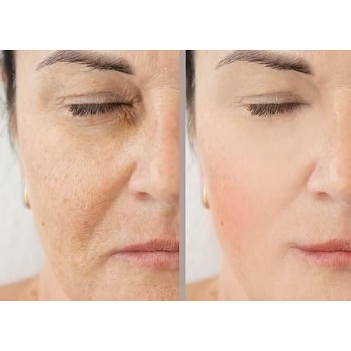 Vitality Precision Skin Phloretin C Serum