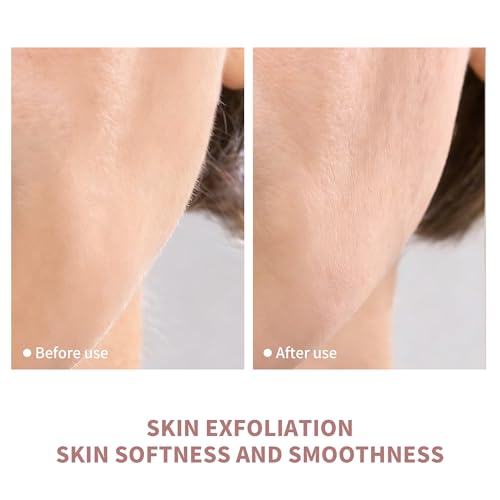 Sonic Dermaplaning Tool For Face - Painless Facial Hair Removal For Women,Anti-Nick Exfoliator For Sensitive Skin,Blades With A Protective Microblade System(Beginner Friendly)10refill Blades