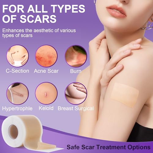 Silicone Scar Sheets, Medical Grade Silicone Scar Tape (1.6" x 60"), Professional Scar Removal Treatment, Reusable, for Healing Keloids, Surgeries Scars, C-sections, and Burns