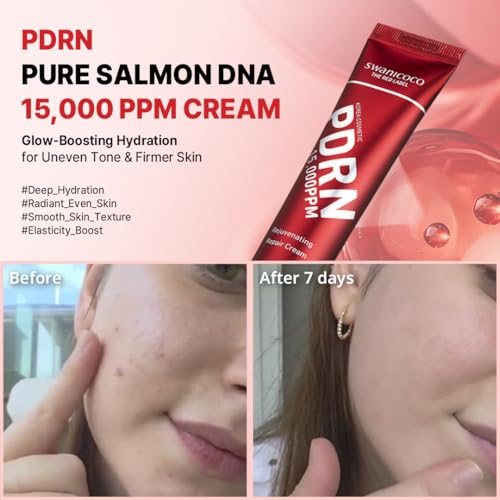 SWANICOCO Premium PDRN Recovery Cream, 15,000ppm High-Concentrate Salmon DNA, Cica Exosome, Bakuchiol for Advanced Firming, Deep Hydrating Korean Skincare for Radiant Glow 40ml/1.35 fl oz,