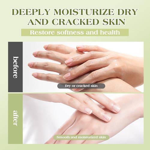 After Sun Lotion with Aloe Vera - Ultra Cooling Aloe Vera for Sunburn Hydration with Cocoa Butter & Rosehip Oil - Hydrating Aloe Lotion After Sun Moisturizer for Dry Skin with Hyaluronic Acid