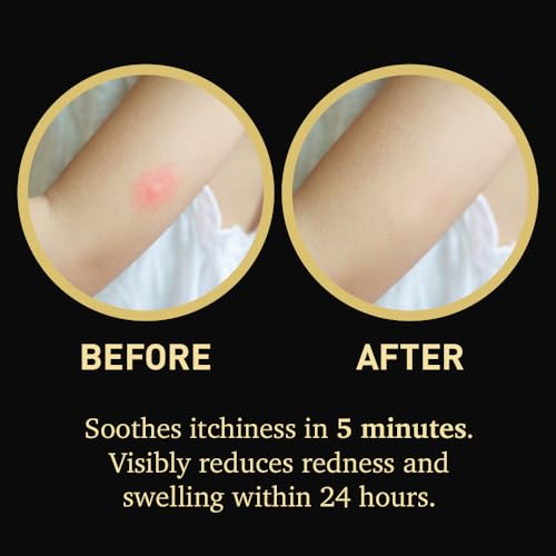Hypochlorous Acid HOCl Gel Serum for Itchy, Irritated Skin from Outdoor Exposure | Cooling Relief | Non-Sting, Fragrance-Free | Gentle for Kids & Sensitive | Lightweight Formula for Daily Use | 2oz