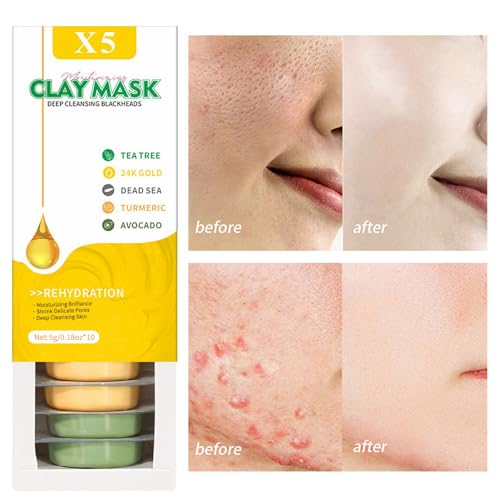 Freeman The Beauty Bag Face Mask Kit, 6 Piece Facial Mask Gift Set, Limited Edition Multi-Masking Kit for Fresh, Glowing Skin, Skin Care Gift for Her