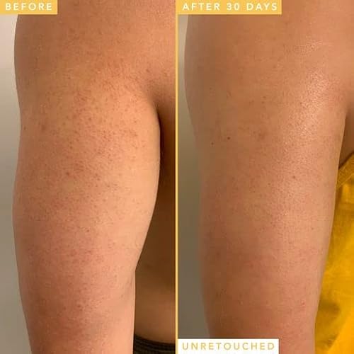 Farmacy Honeymoon Glow Body - AHA and BHA Body Serum with Hyaluronic Acid - Resurfacing Lactic Acid Body Lotion for Dry Skin