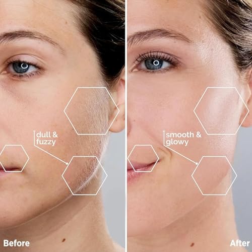 Facial Hair Removal for Women: Painless Face Shaver for Women - Electric Hair Removal Device for Face Lips Peach Fuzz with Light (Paris Blue)