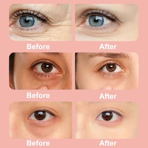 Elitzia Under Eye Red Light Therapy Beauty Device 4 Modes Red Light Therapy Glasses for Eyes Bags, Dark Circles, Puffiness, Wrinkles Fine Lines, Soothing and Refreshing for Women & Men ET110N