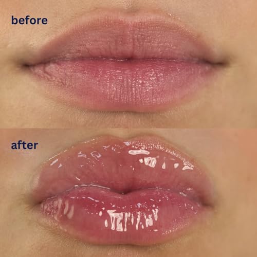 Endless Skin - Daydream - Natural Vanilla Flavor Lip Balm with Jojoba Oil, Hyaluronic Acid and Squalane - Ultra Glossy Finish that Nourishes and Hydrates Your Lips - Vegan and Paraben Free - 15ml